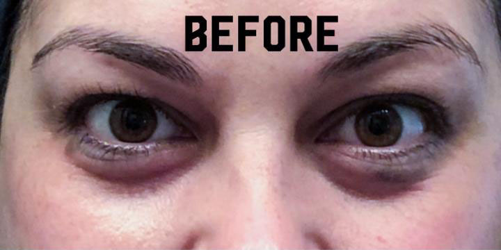 Before and after skincare treatment comparison showcasing improved skin clarity and health.