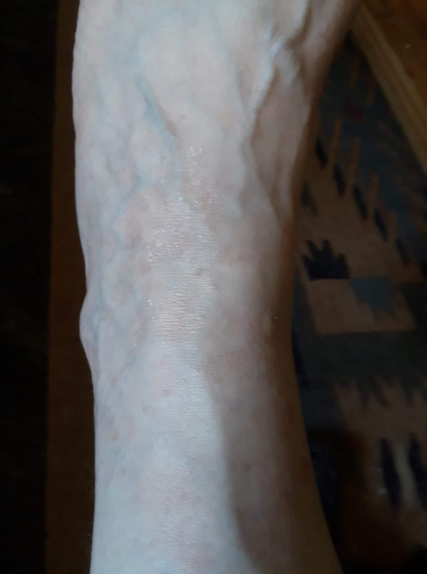 Body Rescue and Soothe cream applied to an ankle for skin repair and soothing relief.