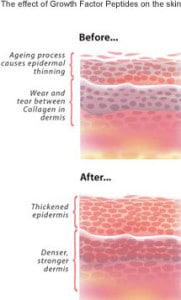 Before and after results showcasing growth factor skincare treatment effectiveness on skin rejuvenation.