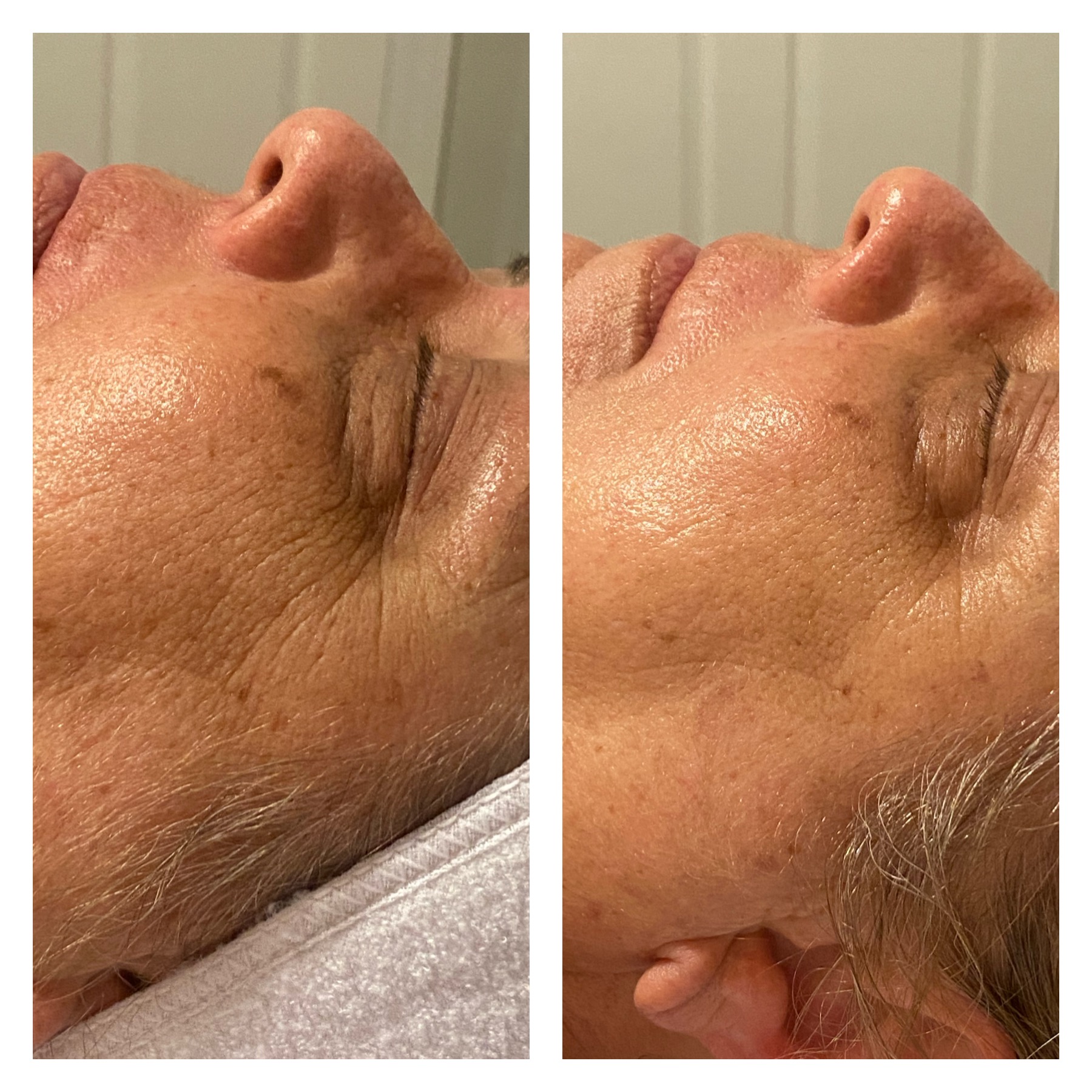 Jaymes mom using anti-aging skincare products for youthful, radiant skin.