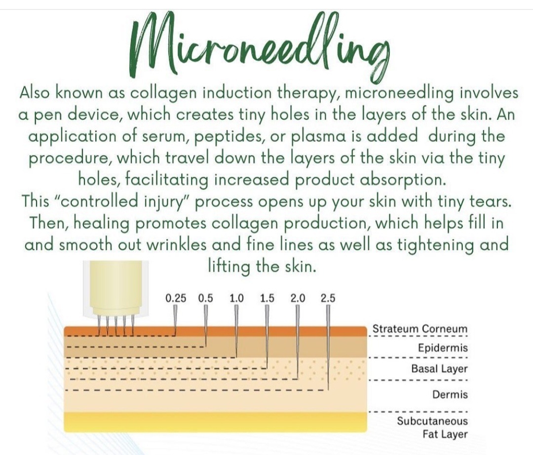 Micro-needling diagram illustrating skin rejuvenation techniques for anti-aging skincare.