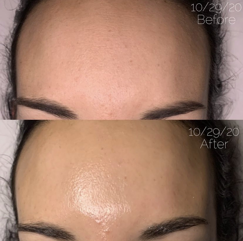 Close-up of Dermaki anti-aging skincare product, showcasing its premium formula and packaging design.