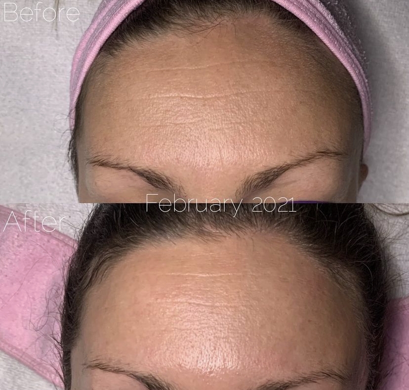 Premium Dermaki skincare product displayed on a clean surface, highlighting anti-aging benefits.