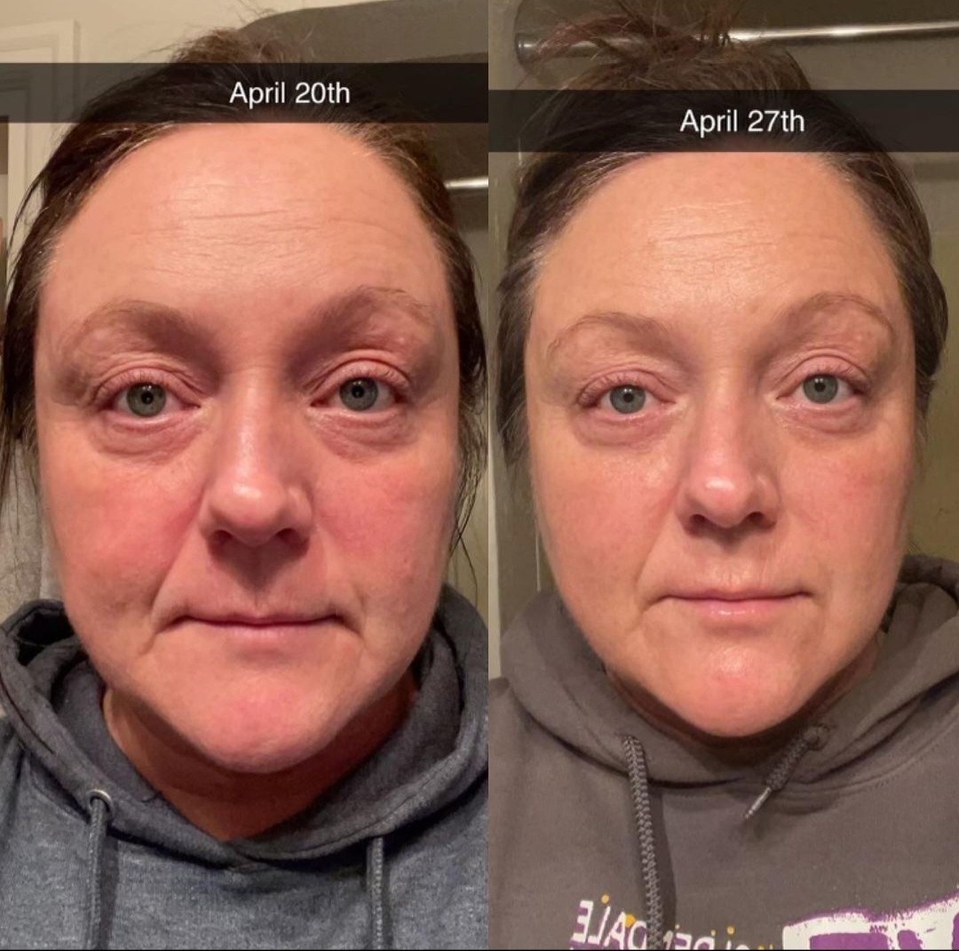 One-week Anti-Aging Kit featuring premium skincare products for youthful, radiant skin.