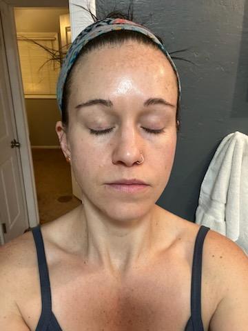 Midway view of Dermakis pigmentation treatment product, highlighting its formula for skin clarity and even tone.