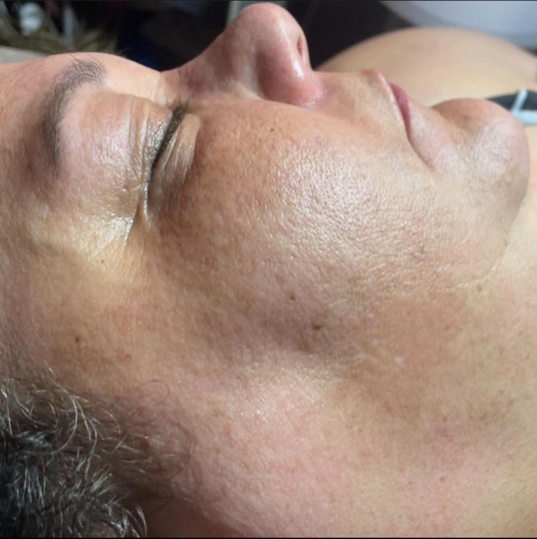 Advanced Aging Powder for pigmentation correction and skin rejuvenation by DERMAKI.