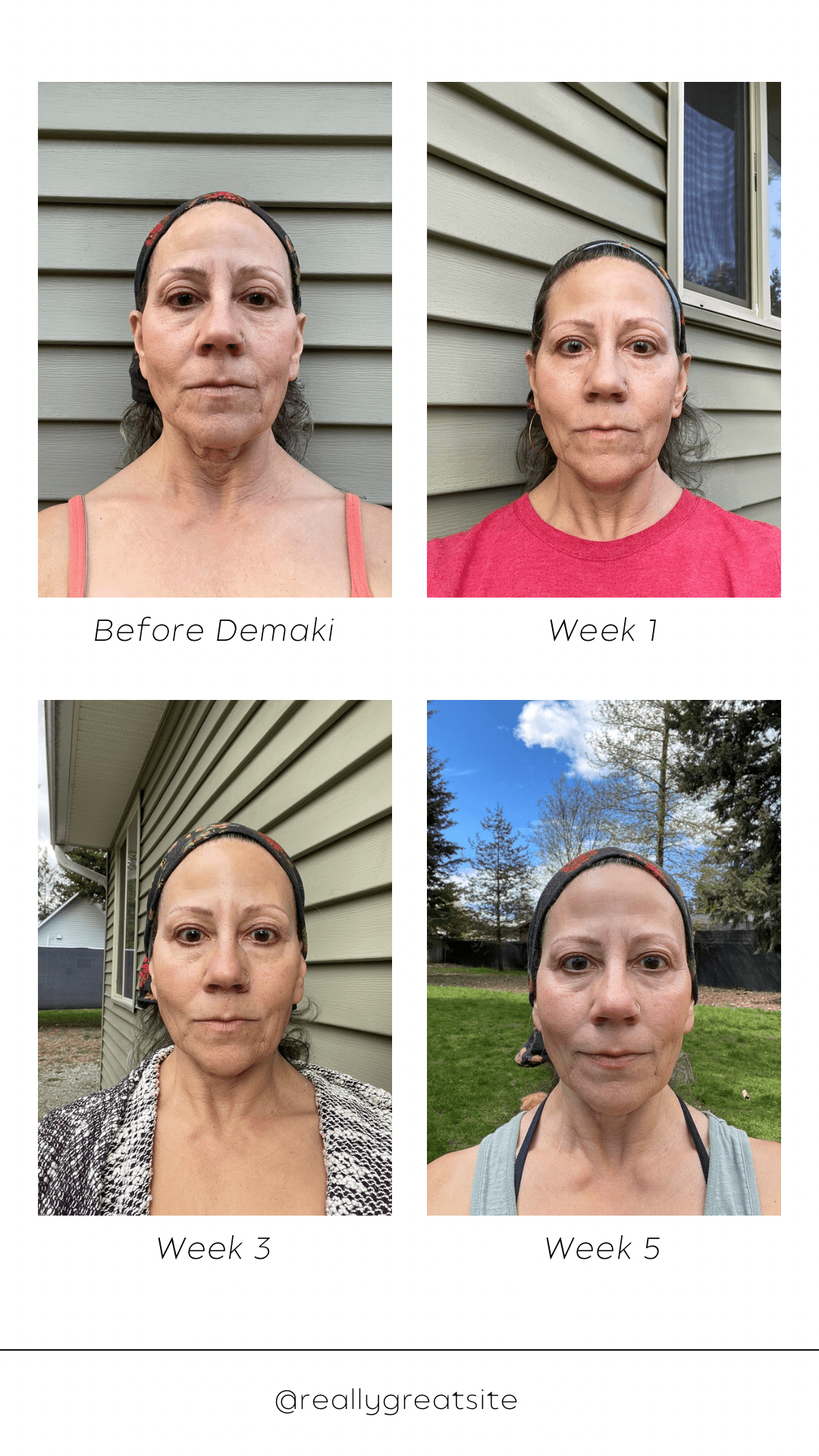 Dermaki non-toxic skincare products for repair and rejuvenation