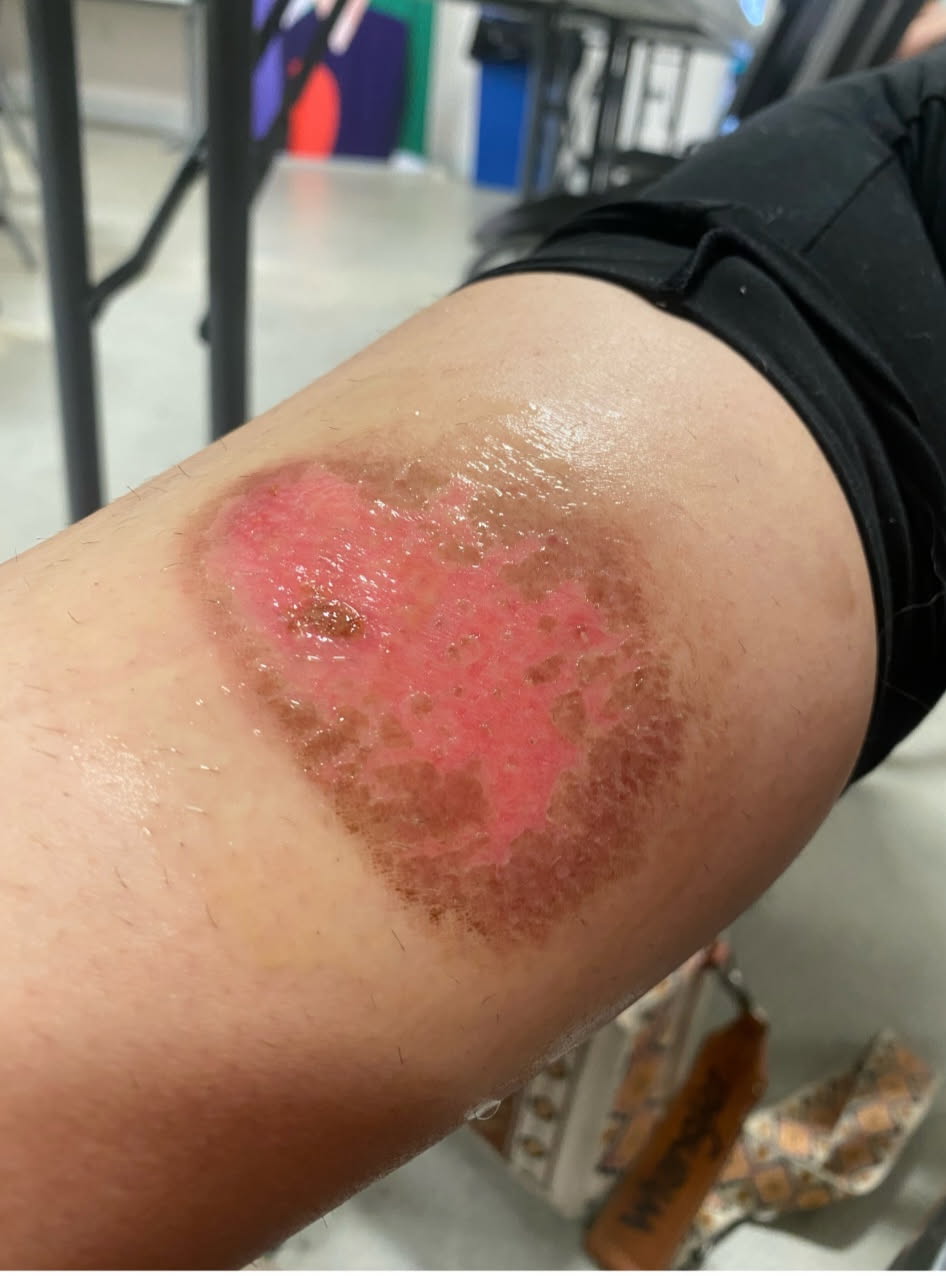 Close-up of a motorcycle engine showing burn marks after one hour of operation, emphasizing performance and durability.